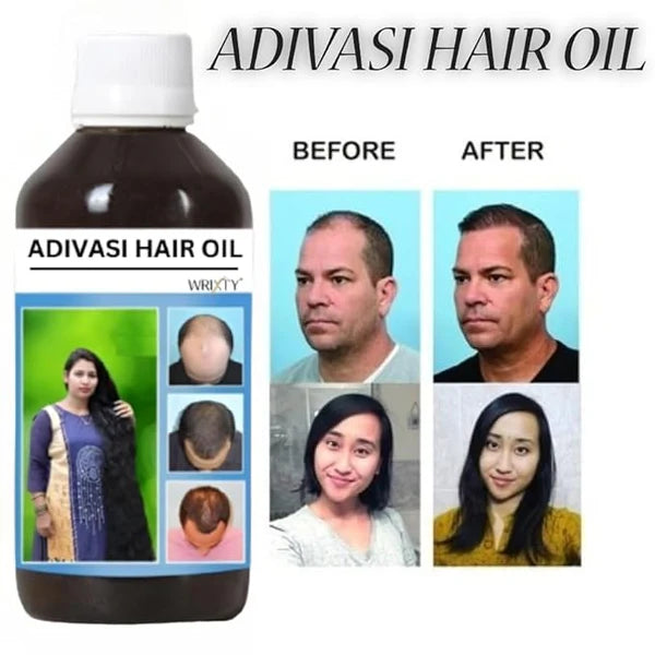 Original Adivasis Hair Growth Oil 2 x 125 ml,Anti‑Hairfall & Anti‑Dandruff with Onion, Castor, Rosemary, Coconut, Amla, Bhringraj & Brahmi |for Men & Women